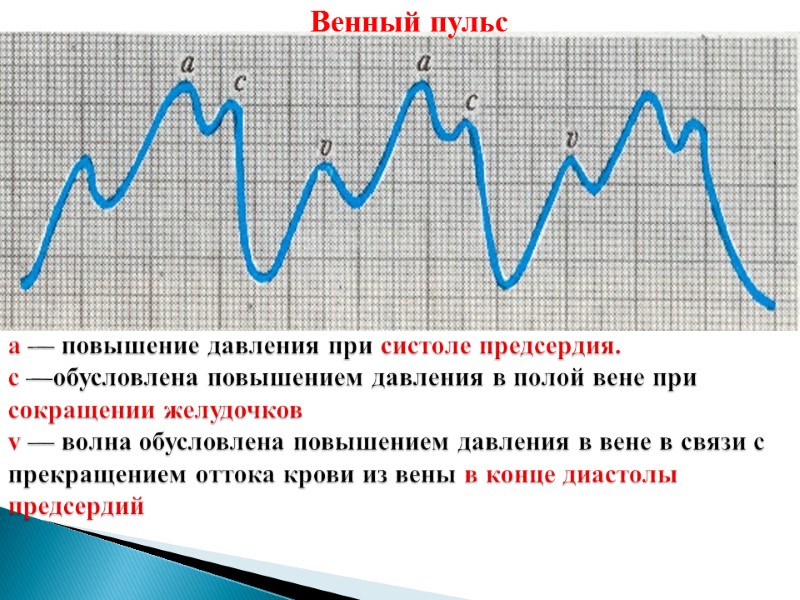 а — повышение давления при систоле предсердия.  с —обусловлена повышением давления в полой